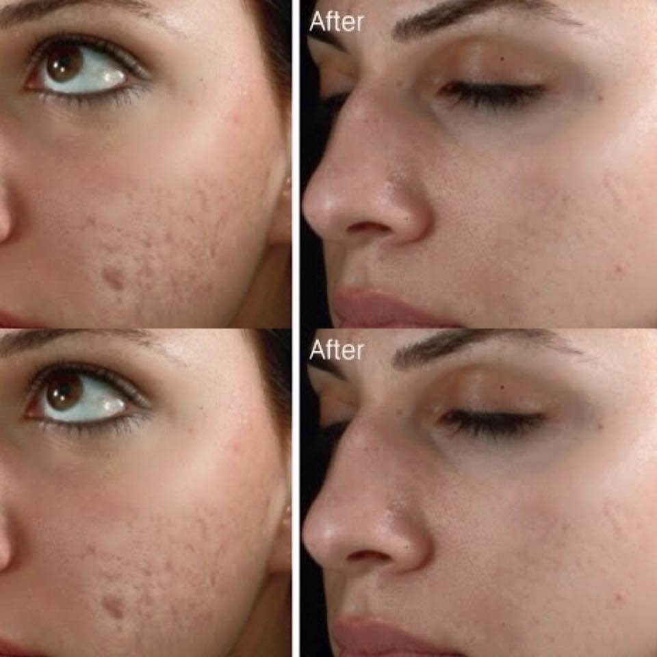 Before & After Transformative